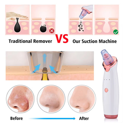 Blackhead Remover Pore Acne Pimple Removal Face T Zone Nose Water Bubble Cleaner Vacuum Suction Facial Diamond Steamer Oil Dirty